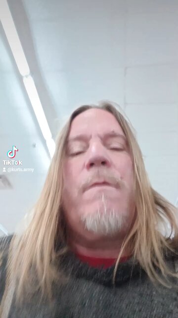 Kurt Cobain's X-Ray's