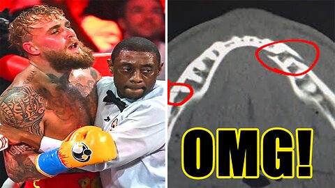 Jake Paul drops HORRIFIC news after Jaw Surgery from getting F**KED UP by Anthony Joshua!