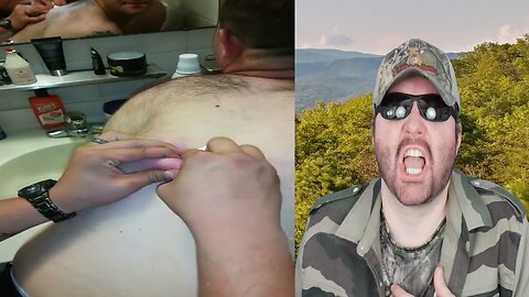 Squirting Puss Out Of An Ingrown Hair!!!!!! - Reaction! (BBT)