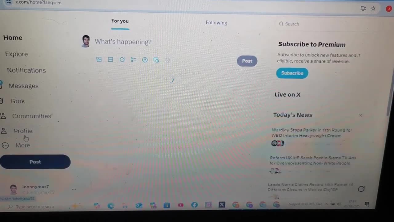 Elon Musk X Melt Down