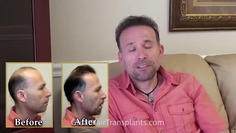 Dr. Brett Bolton Delivers Remarkable Hair Restoration Results
