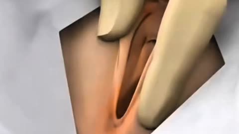 Female Catheterization Procedure Explained Medical Education