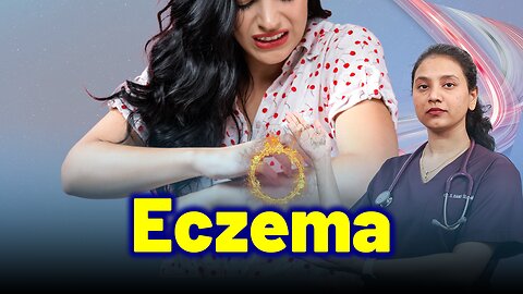Solutions for Eczema , Atopic Dermatitis. | Treatment Cure Relief Medicine | Skin Hair Nail |