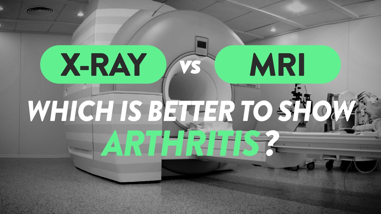 Can you see arthritis better on x-rays or MRI?