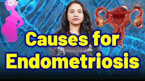 Important Causes for Endometriosis. | Treatment Cure Medicine Surgery | Gynaecology Women Female |