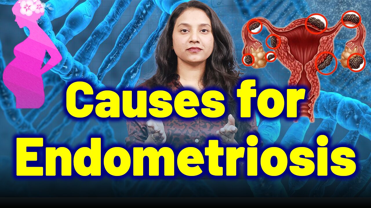 Important Causes for Endometriosis. | Treatment Cure Medicine Surgery | Gynaecology Women Female |
