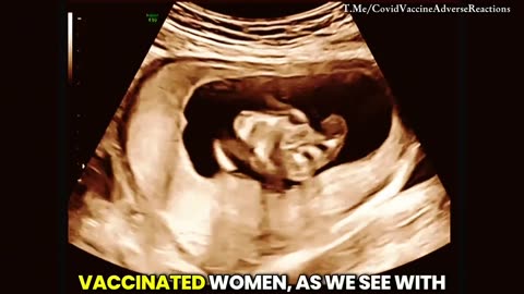 The vaccines were intentionally designed to sterilize the whole human race for the new world order