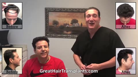 Dr. Brett Bolton’s MaxHarvest™ Hair Transplant: Incredible Results for Patient Peter