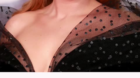 Amy Schumer lost weight. That’s not a crime!