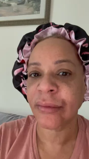 DIY next day after lip disolver!