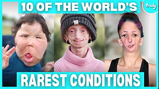 10 Incredible People Who Defied The Rarest Conditions | BORN DIFFERENT