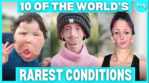 10 Incredible People Who Defied The Rarest Conditions | BORN DIFFERENT