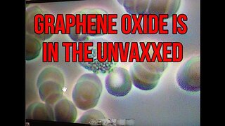 GRAPHENE OXIDE IS IN THE UNVAXXED.. YOUR LOVED ONES