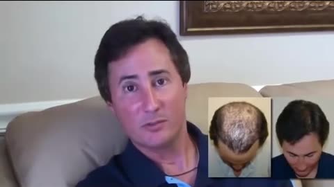 Dr. Brett Bolton: Essential Video for Anyone Considering Hair Restoration