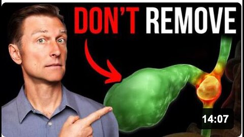 Never Get Your Gallbladder Removed by Dr. Eric Berg