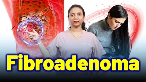Fibroadenoma, Breast Mouse, Lump in Breast. | Treatment Cure Medicine| Gynaecology Women Female |