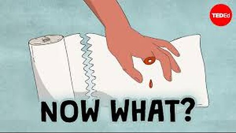 What should you do if you accidentally cut off your finger?