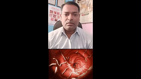 बच्चों के पेट के कीड़ों का इलाज ।