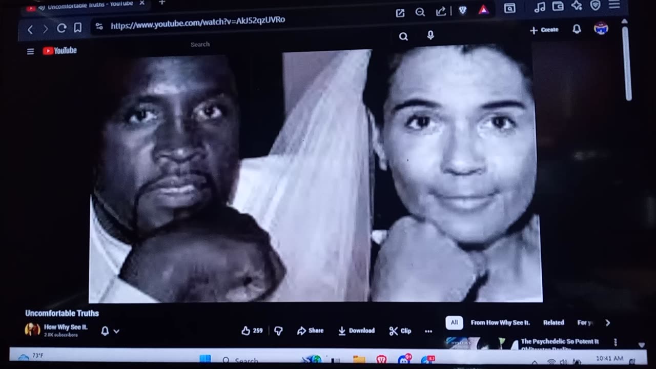 Boxer Conor Nigel Benn & beard/hair transplant