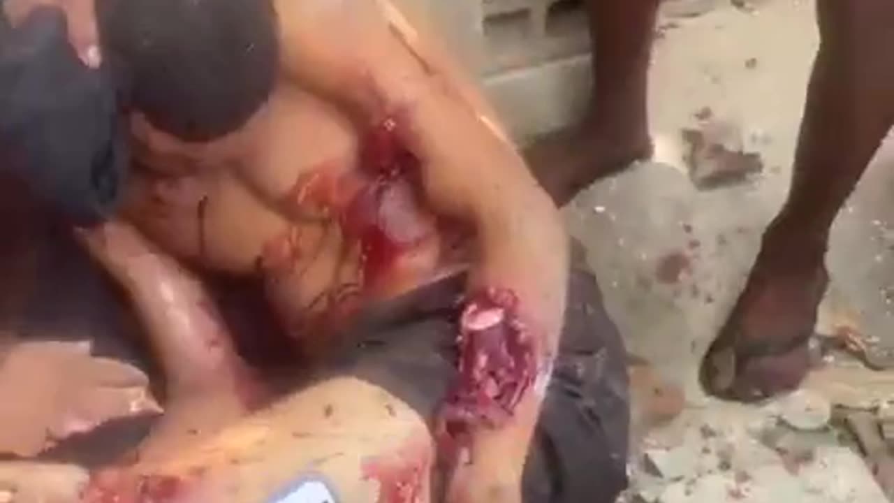 Aftermath of Police Raid in Rios Favela