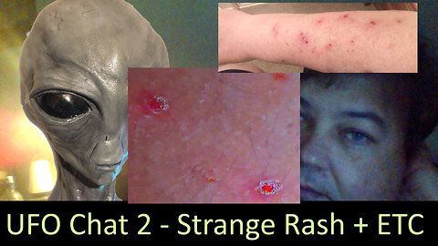 UFO Chat with Paul -2; Weird Rash can I blame Aliens + UFO news and Topics and videos
