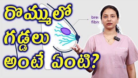 రొమ్ములో గడ్డలు అంటే ఏంటి? What is Fibroadenoma? Breast Mouse Homeopathy Treatment | హోమియోపతి