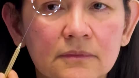 Choosing Between a Subbrow Lift, Upper Blepharoplasty, and Brow Lift | Dr. Kenneth Kim Explains