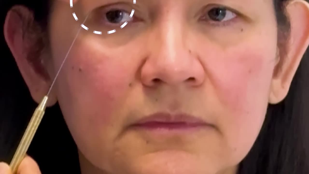 Choosing Between a Subbrow Lift, Upper Blepharoplasty, and Brow Lift | Dr. Kenneth Kim Explains