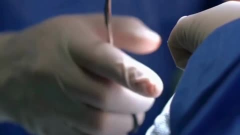 Pain-Free Kidney Stone Treatment in Madurai | Sandheep Memorial Hospital