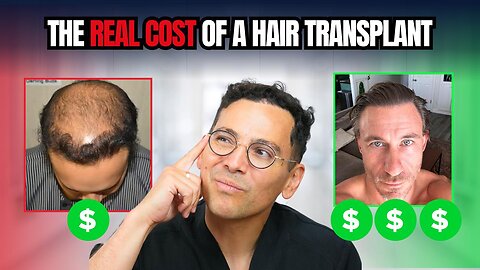 Doctor Explains: The REAL Cost of a Hair Transplant