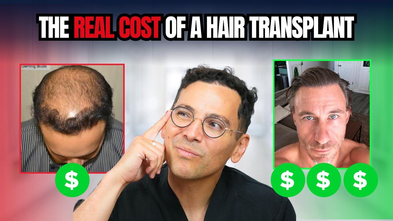 Doctor Explains: The REAL Cost of a Hair Transplant