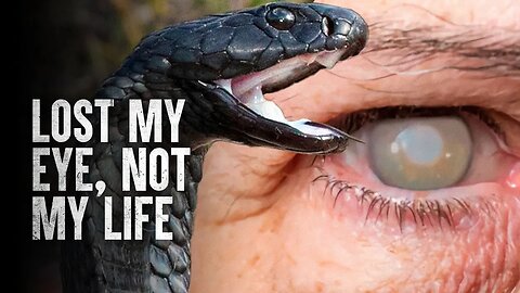 Surviving a Spitting Cobra Attack: Essential Tips for Immediate Action