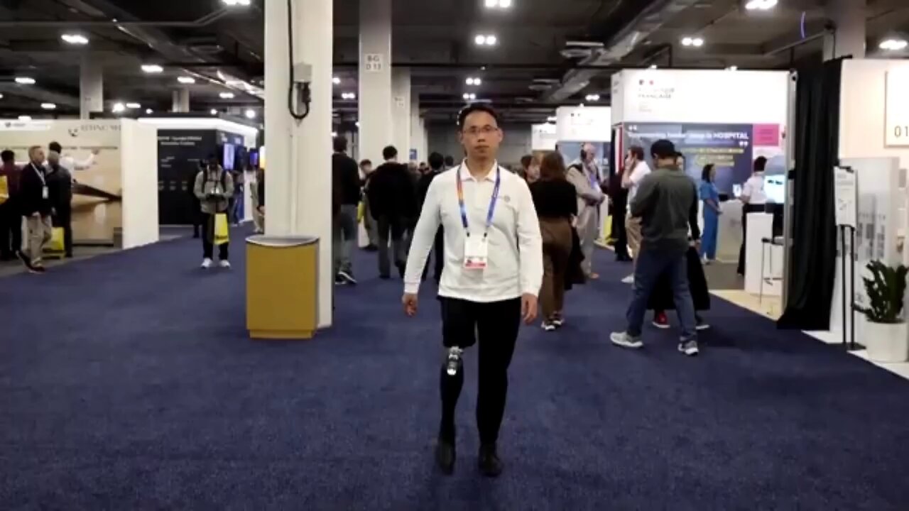 The Bio Leg promises an improvement of life for amputees