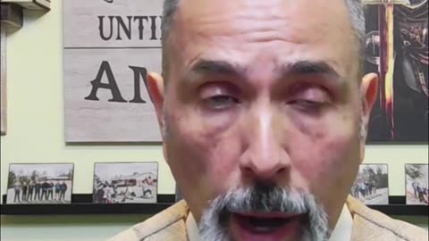 Gut Health Shock: Oncologists Need to Know!