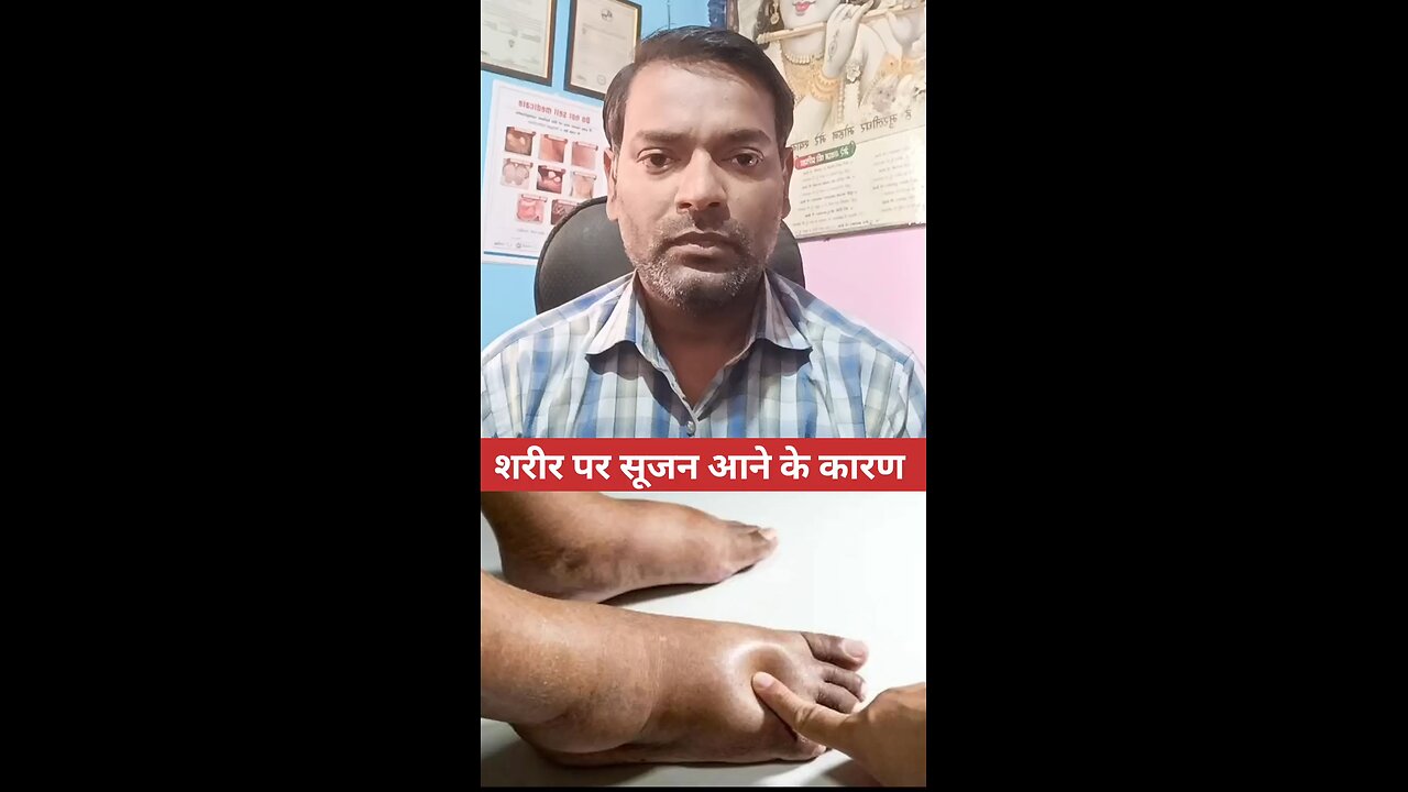 शरीर पर सूजन आने के कारण ।