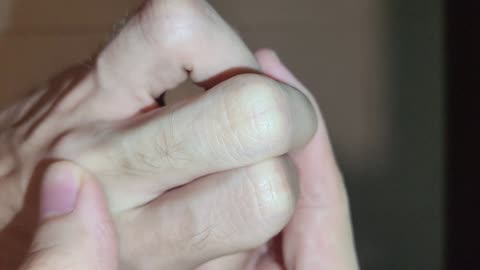 😮💉 First Time Blood Vessel Did This! Is It Normal? | FeedMyCuriosity