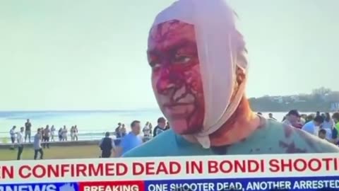 Bondi Fake Shooting Actor Also Survived October 7