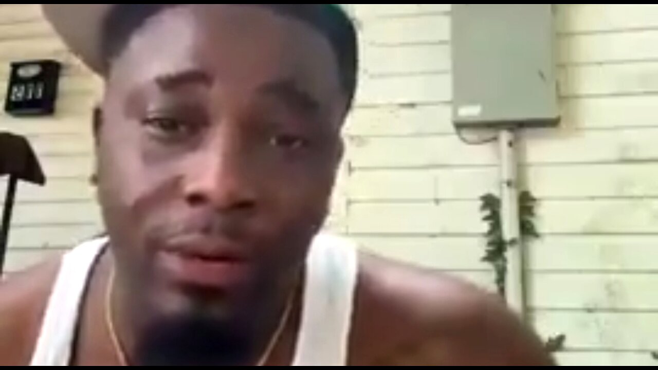 A BLACK MAN WITH "NEGROID FATIGUE" 👊