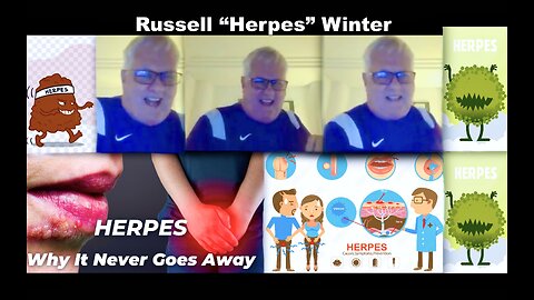 Russell Winter I Have Herpes Admission Leaves Jim Fetzer Joachim Jagopian Victor Hugo Speechless