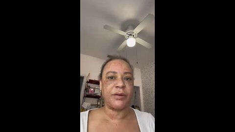 DIY threads on face! After dissolving whole face!