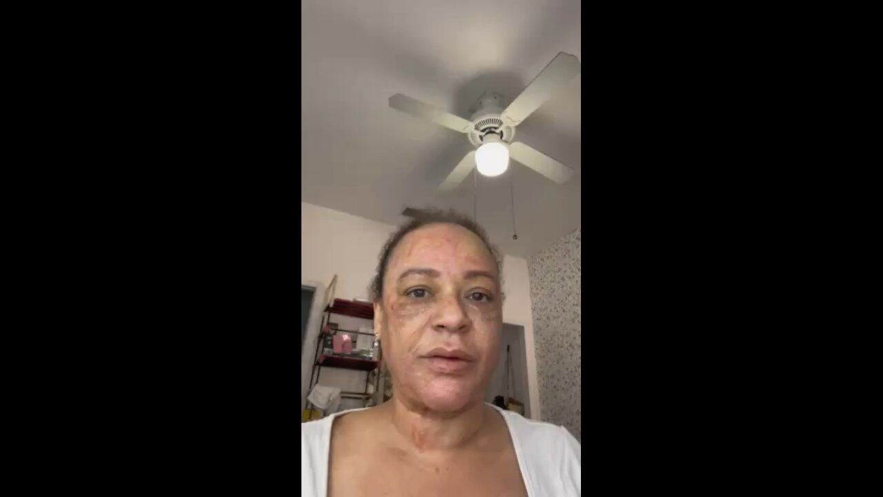 DIY threads on face! After dissolving whole face!