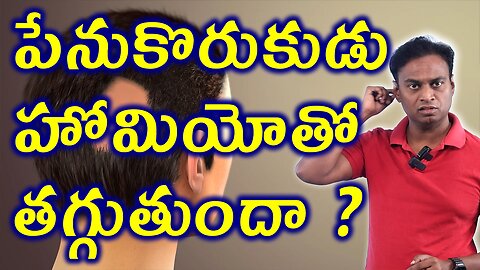పేనుకొరుకుడు హోమియోతో తగ్గుతుందా? Does Alopecia Go Away With Homeopathy? Treatment Medicine Cure