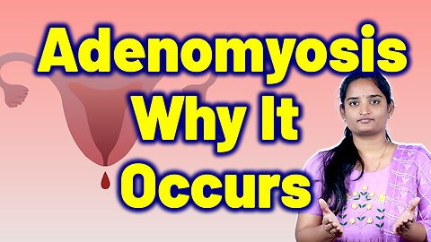 Causes For Adenomyosis, Heavy bleeding uterine condition | Homeopathy Medicine Treatment & Surgery