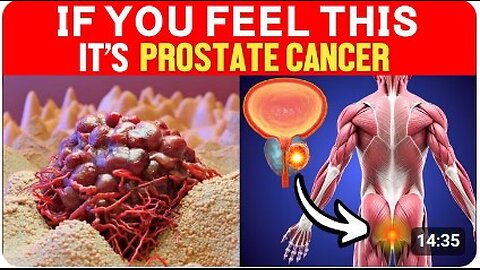 Prostate Cancer- 12 Early Signs and Symptoms MOST PEOPLE MISS. Don’t Ignore!