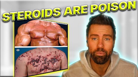 Steroids Are Poison! | Truth Guy