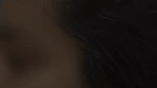 Incredible: PRP Results Before & After 2 Sessions #prptreatment #hairlosstreatm