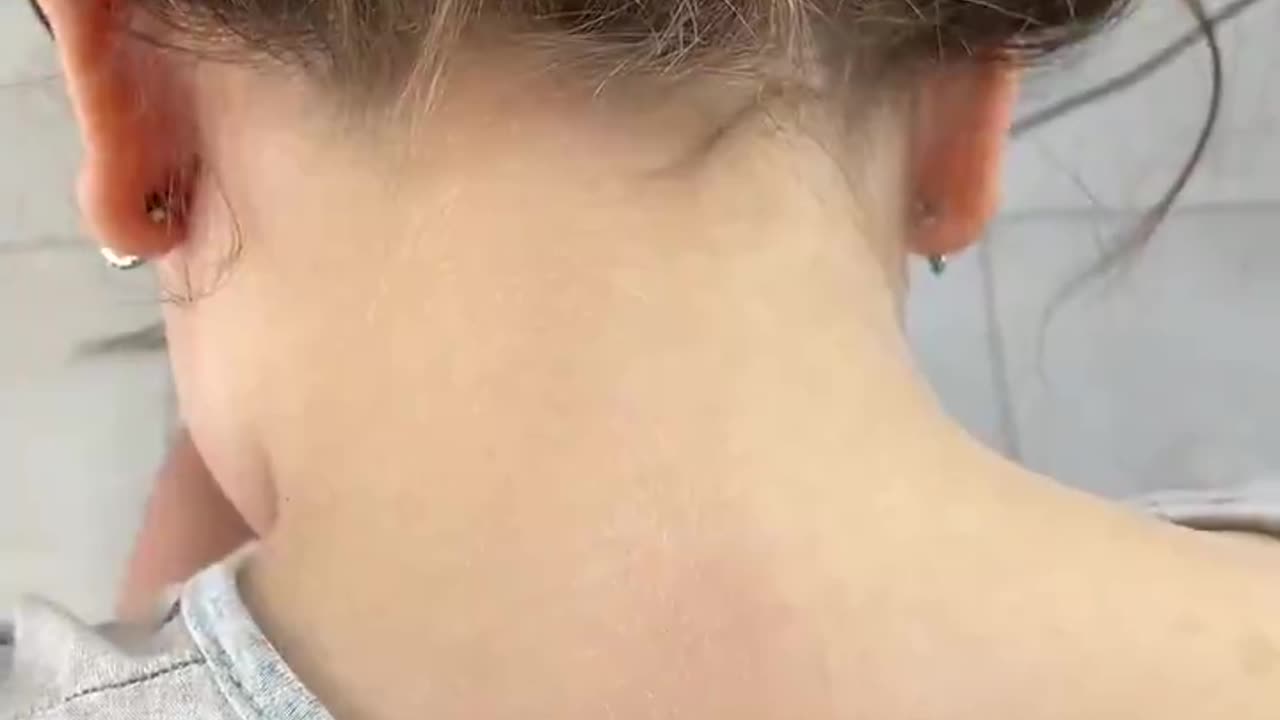 Put baking soda on your neck and you won't believe the results