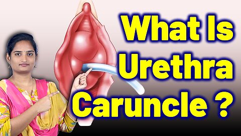 What Is Urethra Caruncle, Urethral Lump, Urethral Growth, Urethral Lesion | Treatment Gynaecology