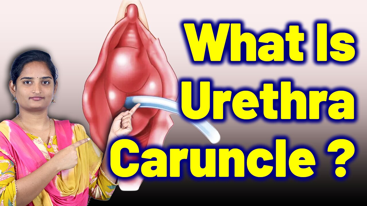 What Is Urethra Caruncle, Urethral Lump, Urethral Growth, Urethral Lesion | Treatment Gynaecology
