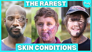 The World's Rarest Skin Conditions | BORN DIFFERENT